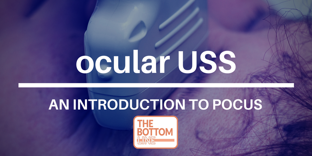 intro-pocus-ocular